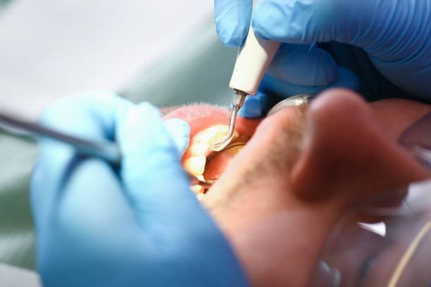 Best Urgent Care for Lost Fillings or Crowns in Talpa, NM