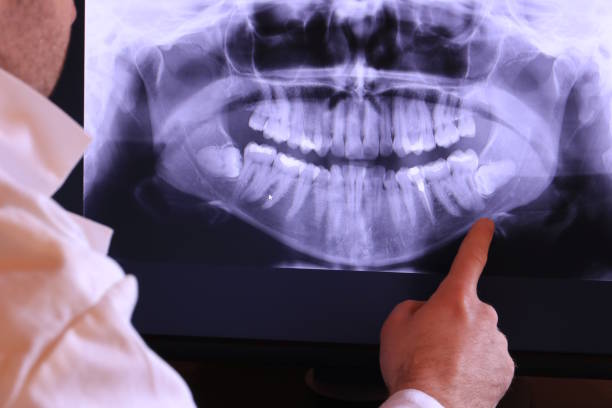 Best Emergency Treatment for Dental Infections or Abscesses in Talpa, NM